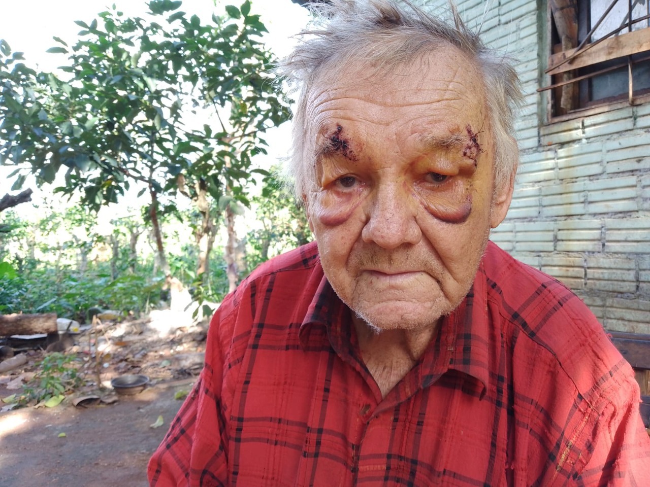 Brutal asalto a un jubilado de 84 años: “Pedían plata y decían te vamos a llenar de plomo, creí que me mataban”