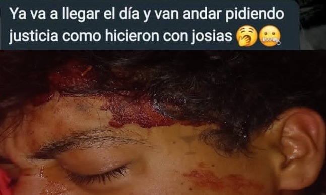 Un menor padeció una brutal agresión y recibe amenazas: “Ya va a llegar el día y van a andar pidiendo justicia como hicieron con Josías”