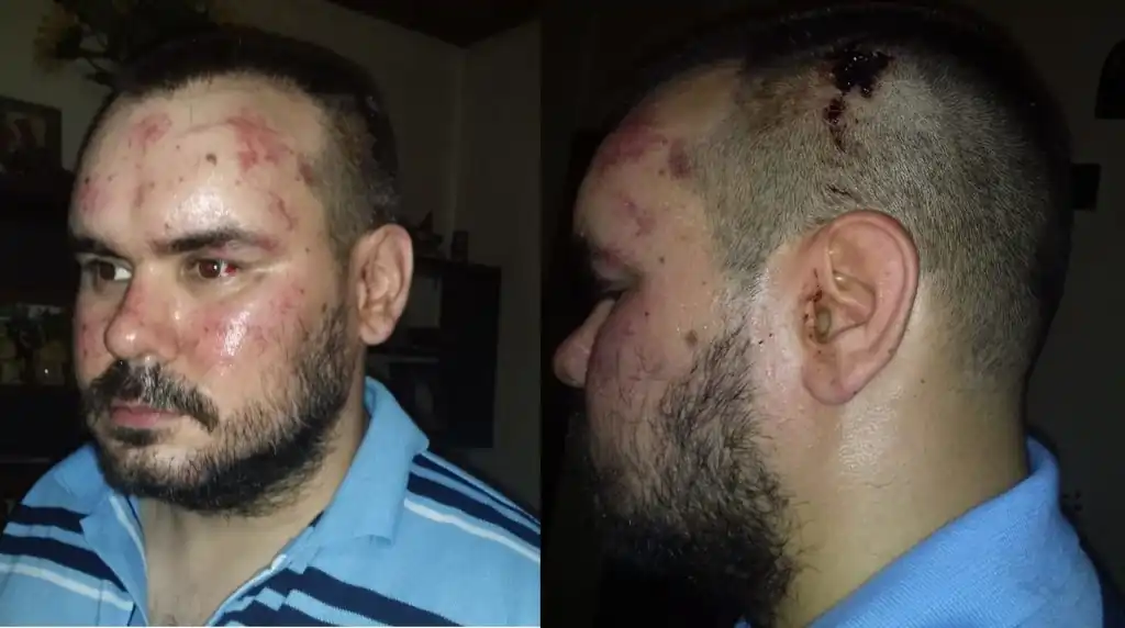 Brutal agresión a un joven que defendió a sus padres jubilados del ataque de una patota