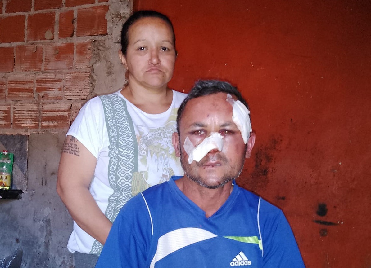 “Fueron por lo menos entre diez los que le pegaron a mi marido y estaban re sacados”