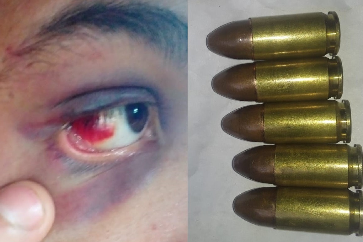 Descontrol y violencia policial en Oberá: uniformados golpearon a un joven, se les cayó un arma y perdieron varias municiones   