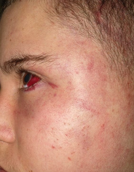 Imputaron a cuatro policías que torturaron a un chico de 15 años en Oberá, pero siguen trabajando