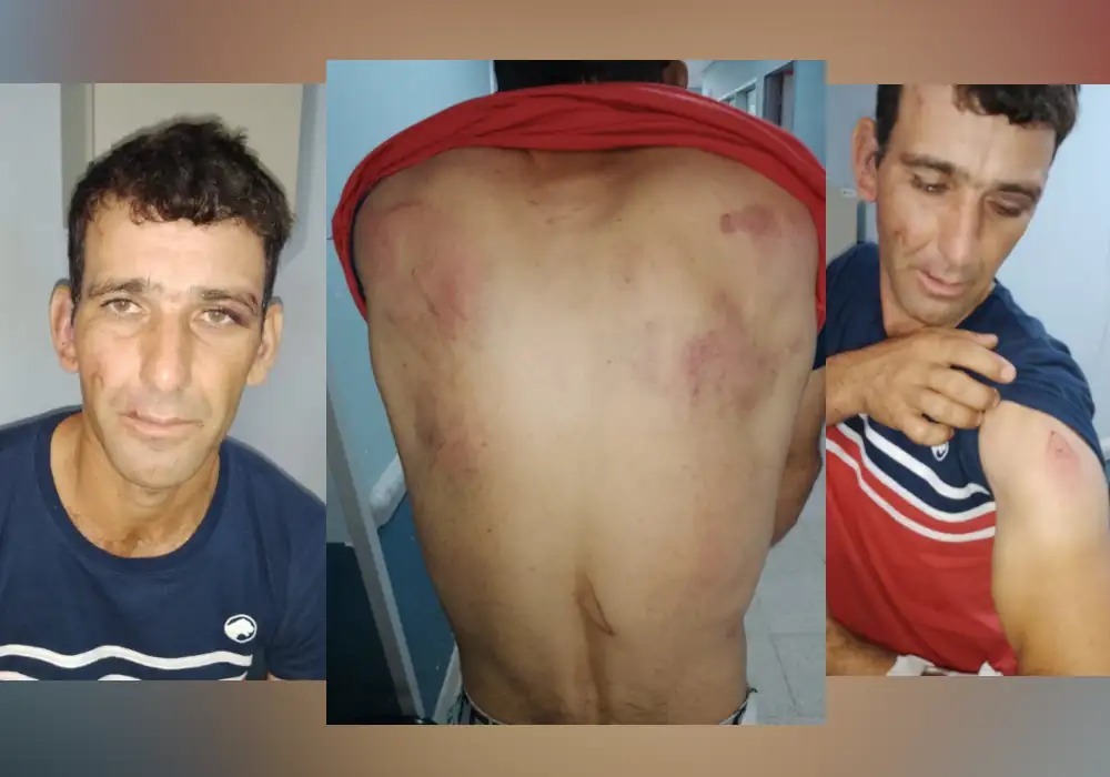 Denunció que un ex policía lo torturó con picana eléctrica y machete durante tres horas en Alba Posse