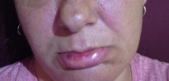 Denunció a su pareja y lo detuvieron, pero enseguida fue liberado y lo primero que hizo fue volver para golpear a la mujer