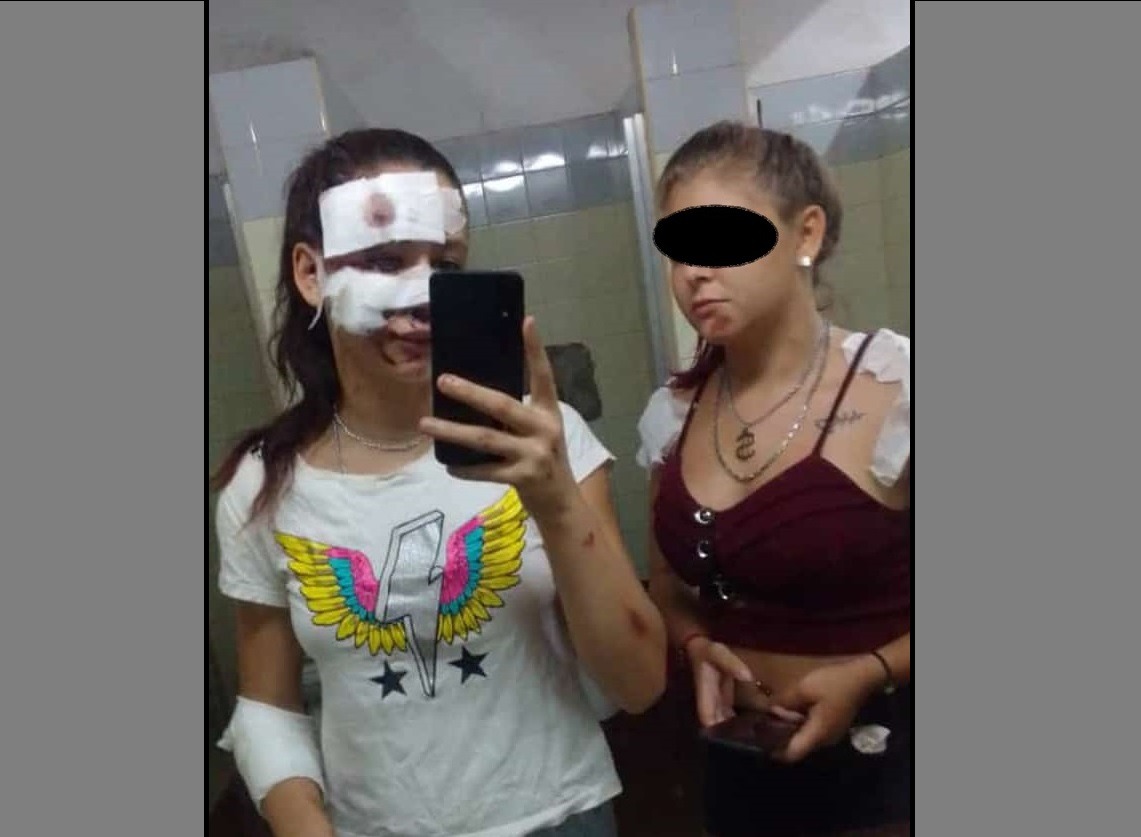 “Ya estamos listas para otra vuelta”, el irónico posteo de las menores accidentadas en Panambí