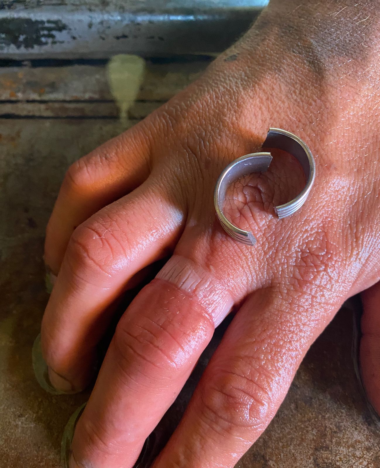 Bomberos socorrieron a un hombre que no podía sacarse un anillo y corría riesgo de perder el dedo