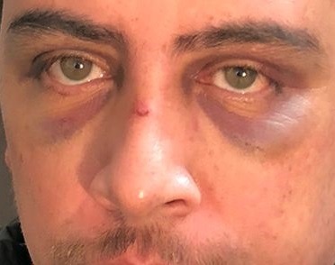 Denunciaron torturas contra un detenido en la comisaría de Campo Viera