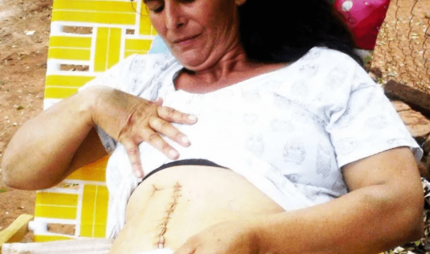 “Me quiso cortar el cuello, pero le empujé y ahí me hincó en la panza”: crudo testimonio de una sobreviviente de la violencia de género