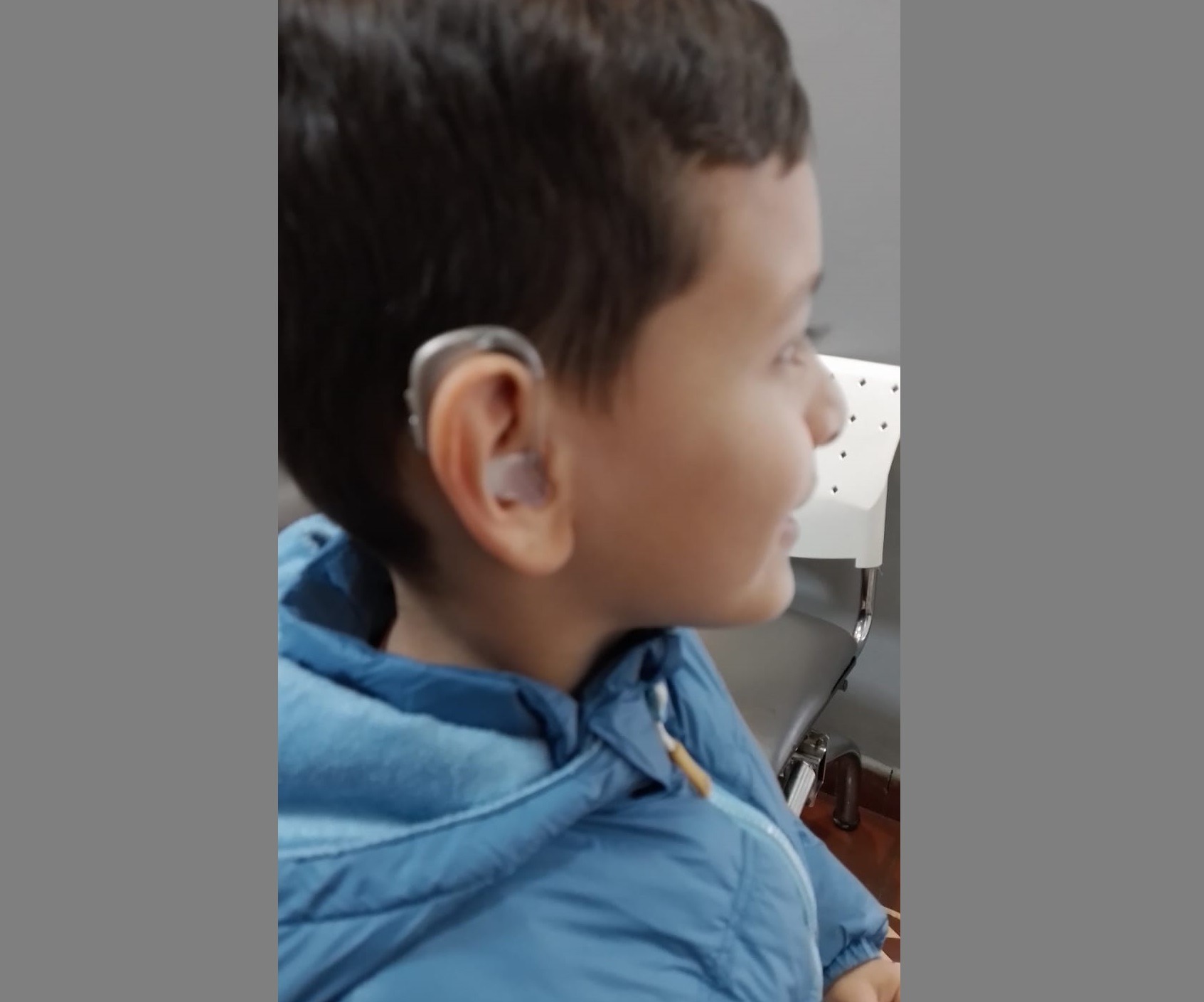 La felicidad de Santino: ya tiene su audífono y aguarda un implante coclear para poder escuchar mejor