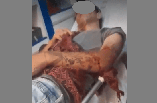 Una menor de 17 años apuñaló a su ex novio minutos antes de año nuevo en Oberá