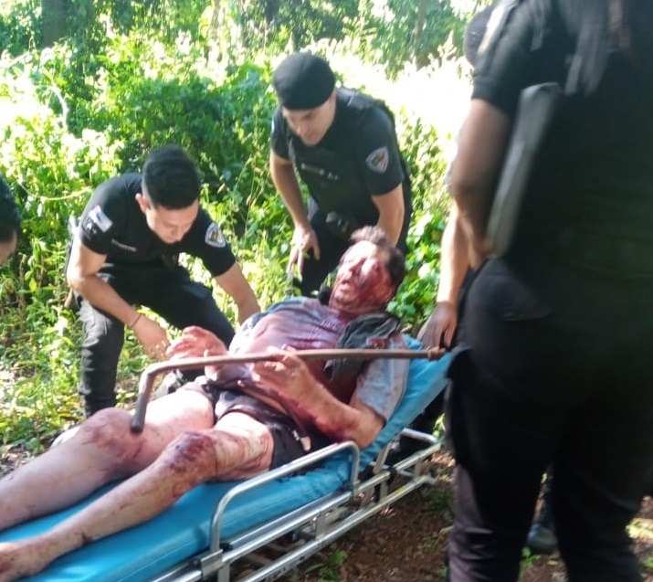 Detuvieron a sospechoso de propinar una feroz paliza a un discapacitado para robarle