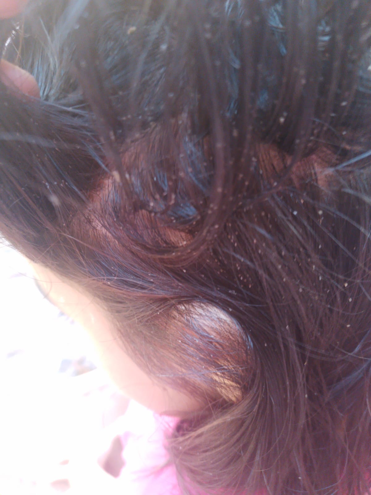 Agentes sanitarios y policías asistieron a tres hermanitos en situación de abandono y llenos de piojos