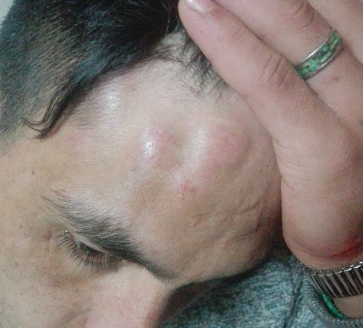 Otro detenido en la cárcel de Oberá denunció golpes y amenazas