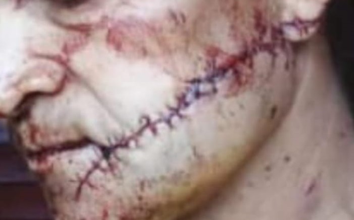 Buscan a sospechoso de machetear y desfigurar a un hombre en el barrio San Miguel de Oberá