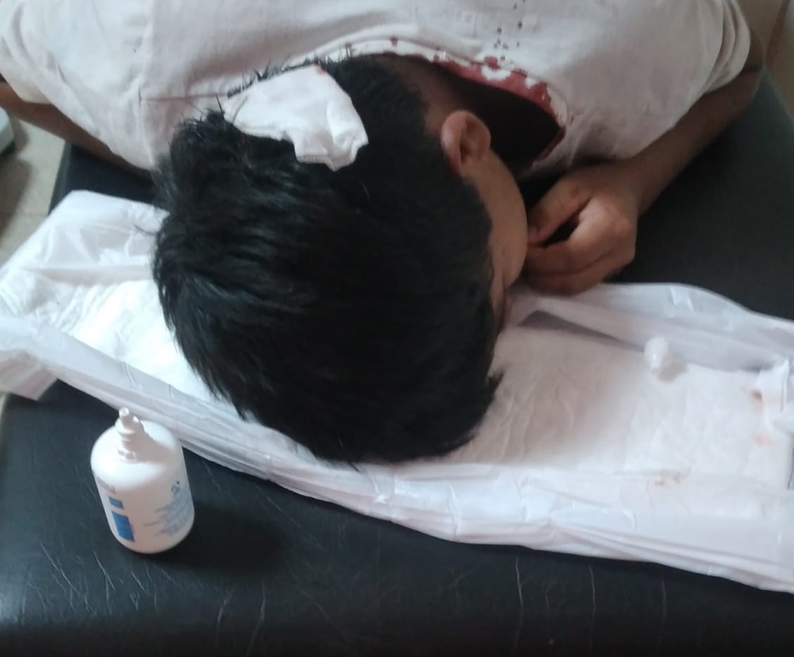 Violencia en el fútbol obereño: menor resultó lesionado por incidentes en la final de cuarta división