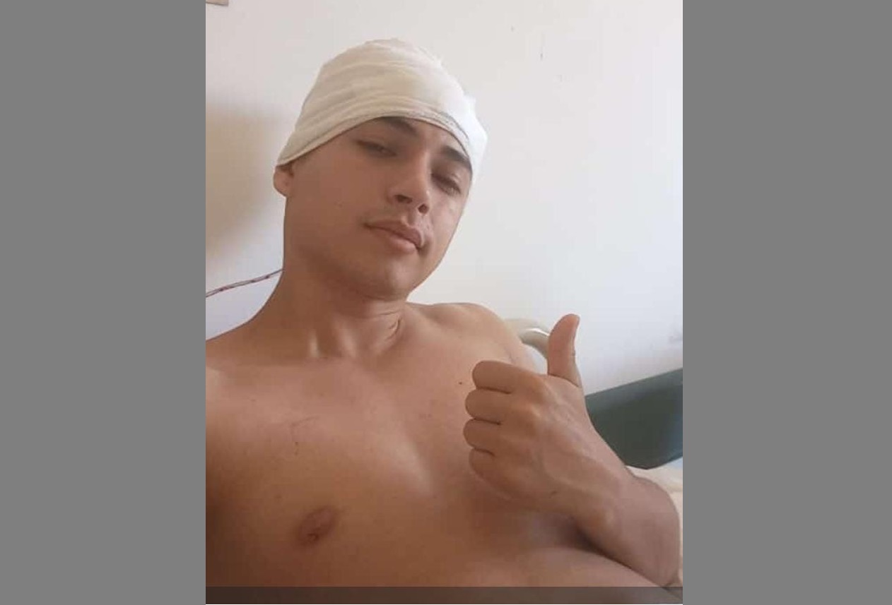 Milagrosa recuperación del joven obereño con fractura de cráneo por agresión de una patota