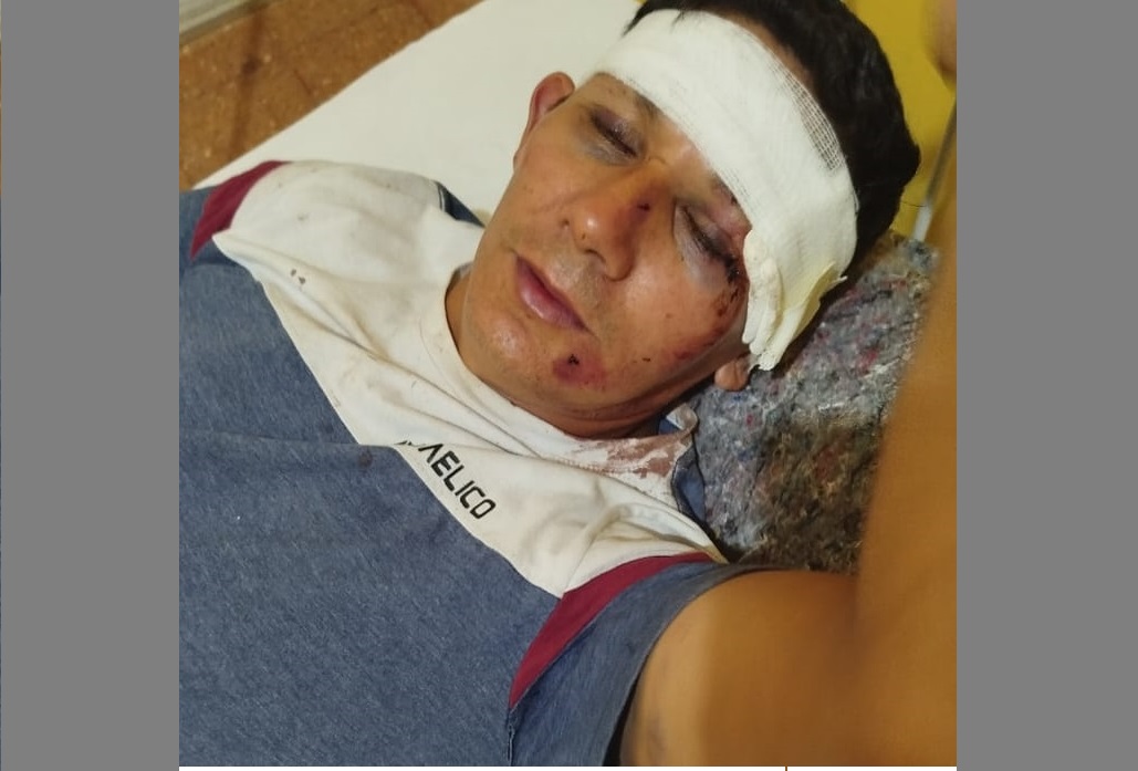 “Lo desmayaron y le siguieron golpeando”: otro grave caso de brutalidad policial