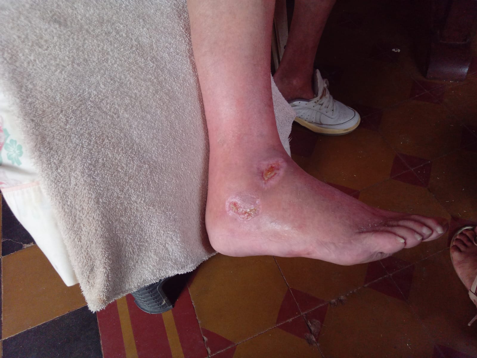 “Gracias a nosotros vos estás caminando, sino te hubieran cortado las dos piernas”: lamentable accionar de médicas del Hospital de Oberá