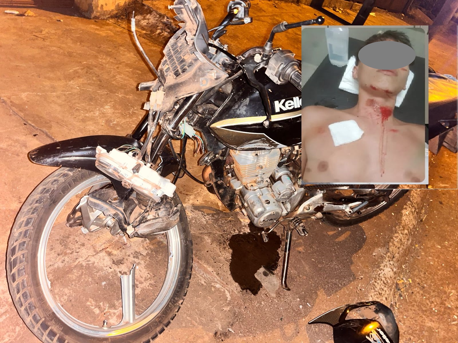 Borracho chocó una moto estacionada y lesionó a un menor en Barrio Norte: vecinos reclaman lomo de burro