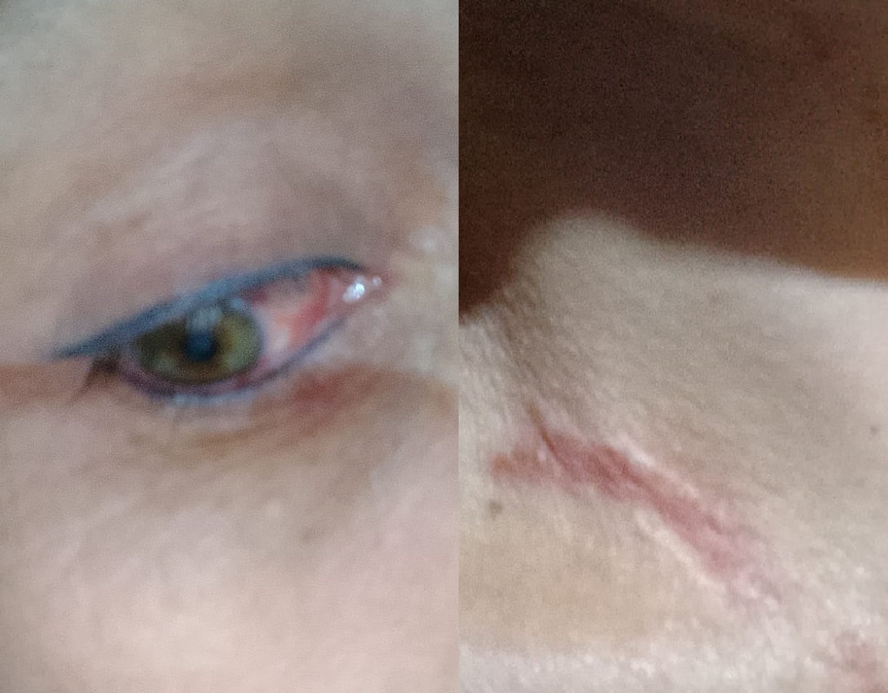 Amigas se desconocieron en la bailanta, se golpearon y terminaron en el Hospital