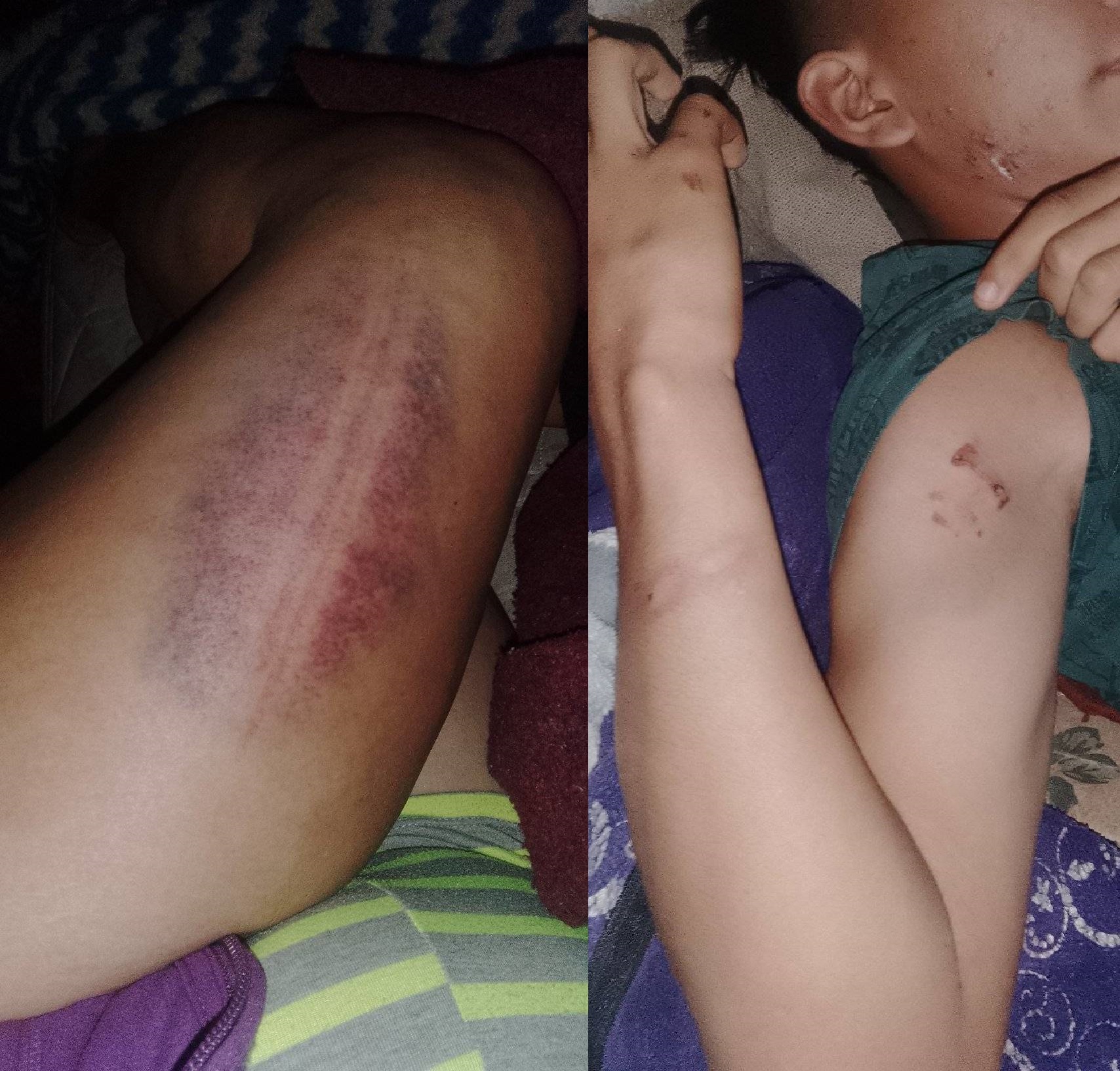 «Nos golpeó, amenazó, no fue preso y ahora nos molesta»: crudo relato de una víctima de violencia