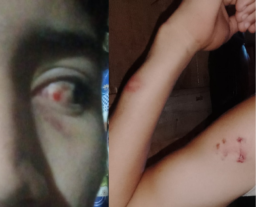 “Mi hijo fue muy valiente, me salvó la vida”: crudo relato de una obereña víctima de violencia