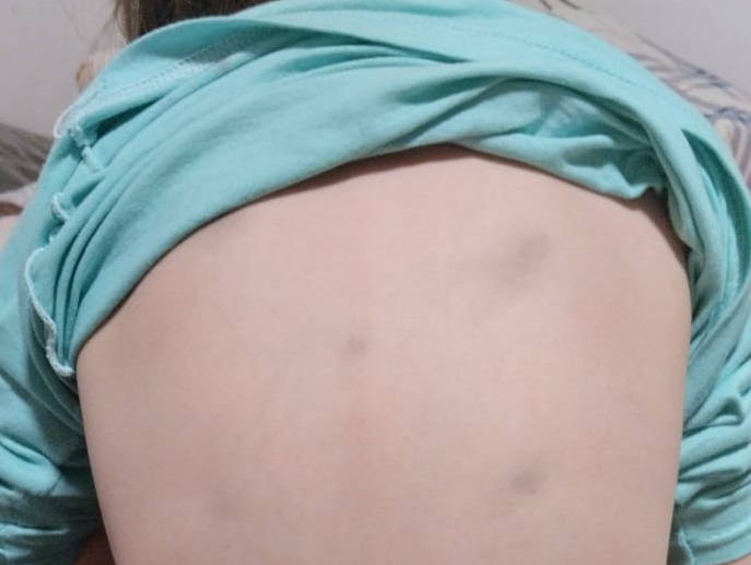 “Mi hija viene llena de moretones porque la madre le pega mucho”: testimonio de un padre desesperado