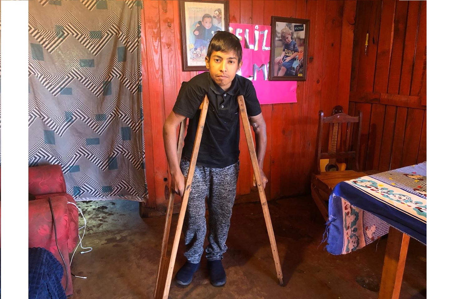 “Es una situación desesperante”: tiene 24 años, afronta su 25° cirugía y requiere de la solidaridad de los obereños