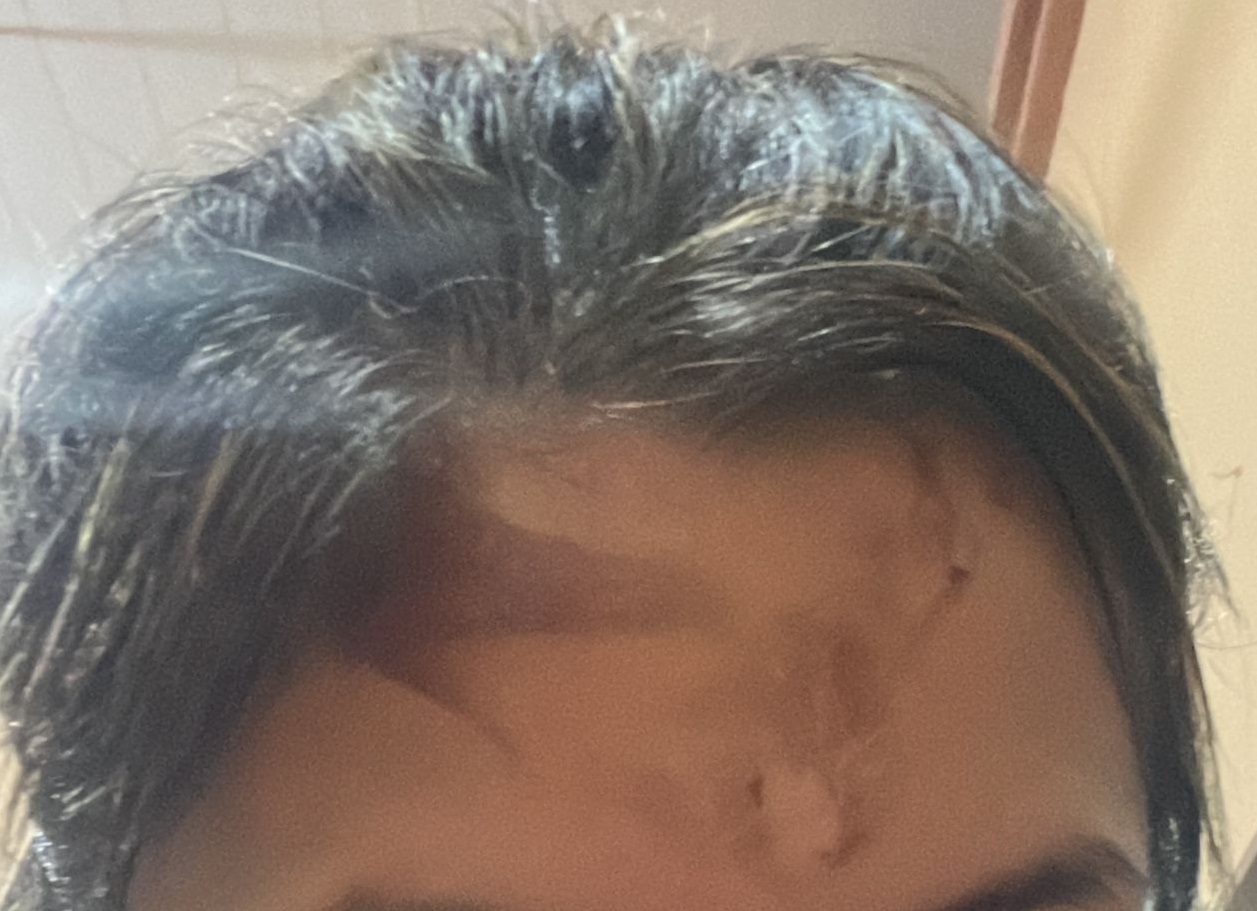 “Discutimos y me tiró agua caliente”: grave denuncia contra un oficial de policía obereño que sigue libre