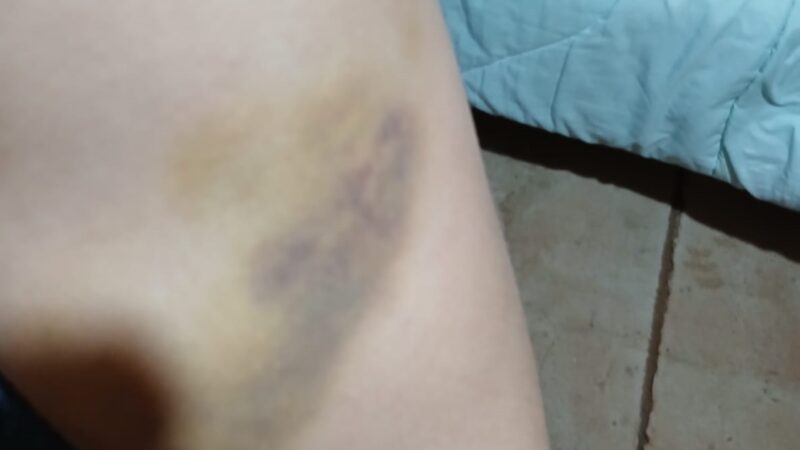 “Para que no me mate, decidí escaparme”: crudo relato de una obereña víctima de violencia de género