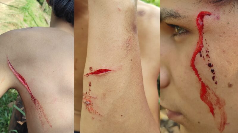 Menor de 15 años fue atacado a machetazos por un vecino en barrio Villa Blanquita