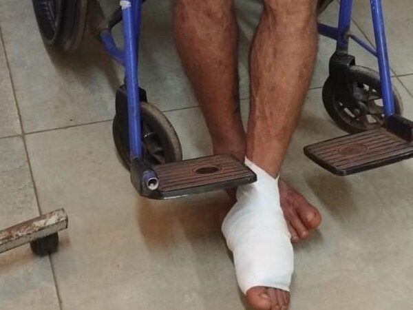 Tiene antecedentes y esta madrugada recibió un balazo en un pie: investigan qué pasó