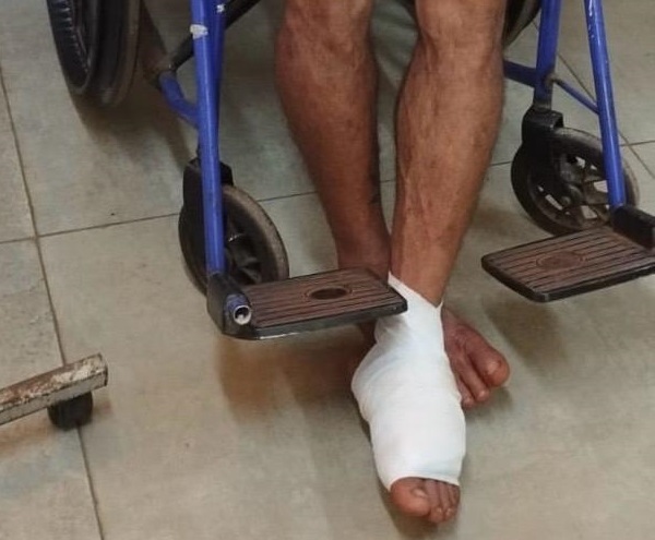 Tiene antecedentes y esta madrugada recibió un balazo en un pie: investigan qué pasó