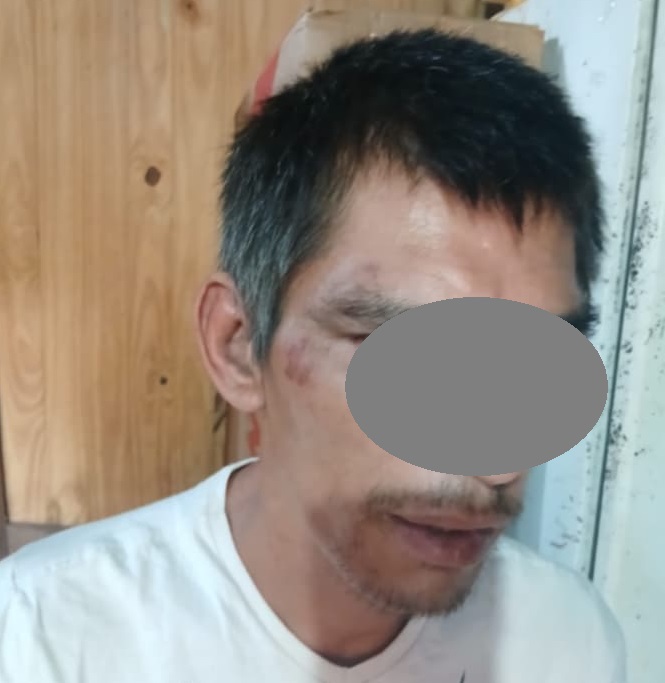 “El hermano le pega y le saca la pensión”: denuncian maltrato a un discapacitado en Cien Hectáreas