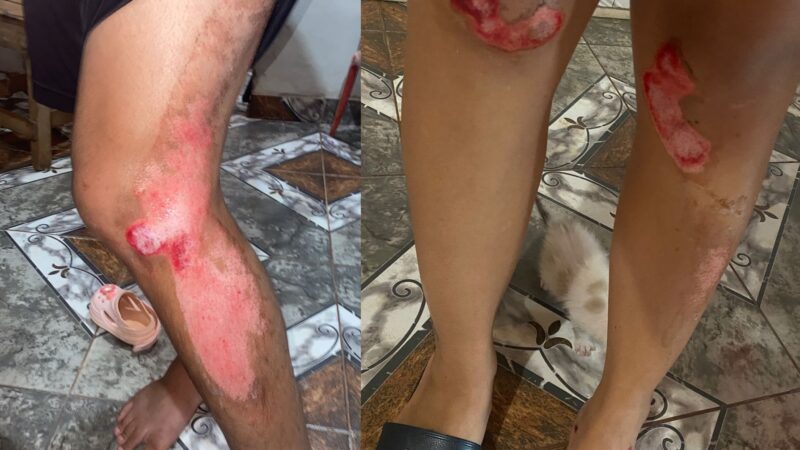 “Nos podía haber matado”: pareja obereña y su nena de 2 años viajaban en moto, una camioneta los chocó de atrás y escapó