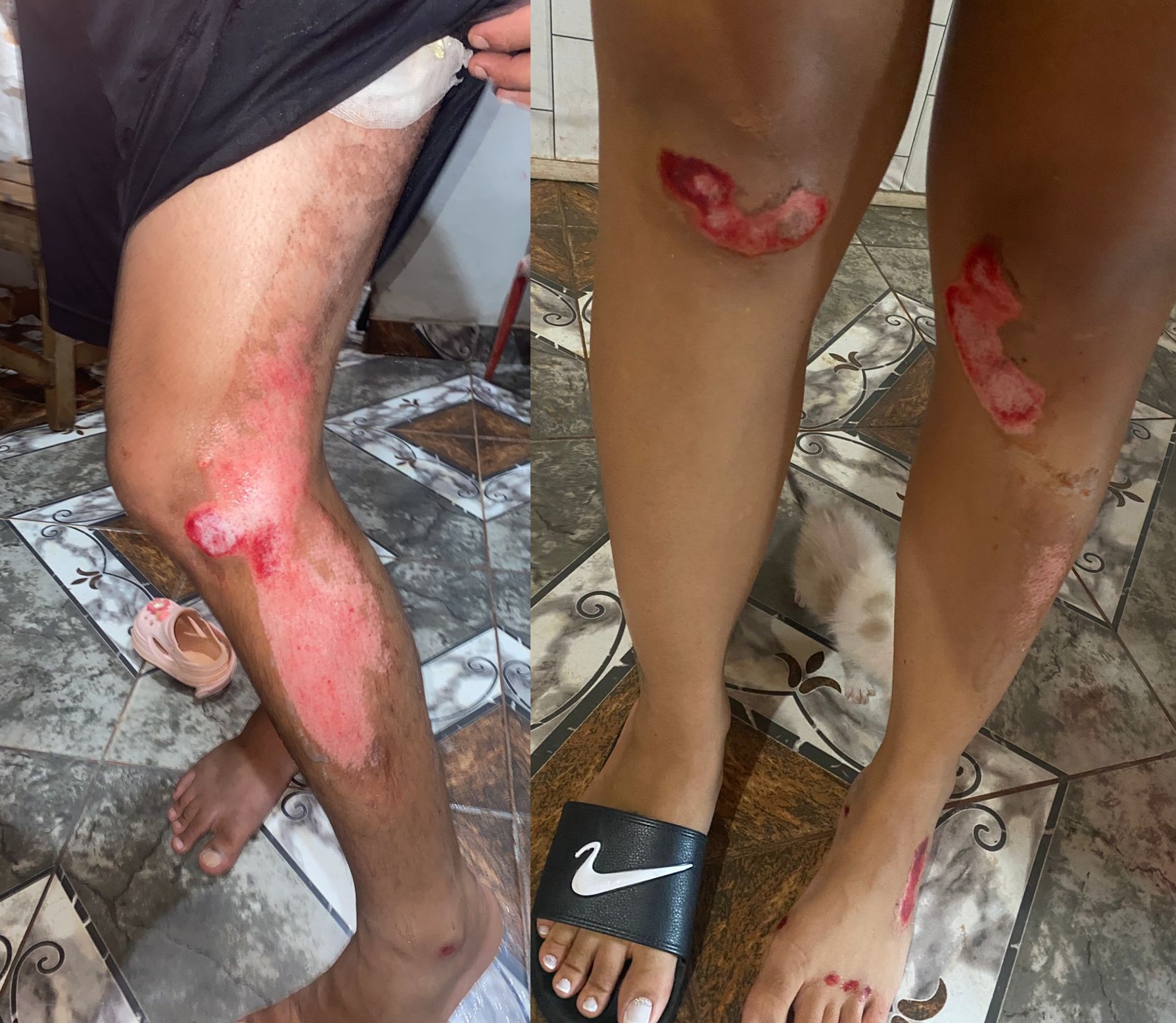 “Nos podía haber matado”: pareja obereña y su nena de 2 años viajaban en moto, una camioneta los chocó de atrás y escapó