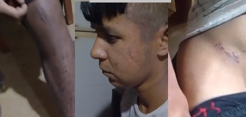 Violencia policial en Villa Bonita: examen médico confirmó contusiones y excoriaciones en la víctima