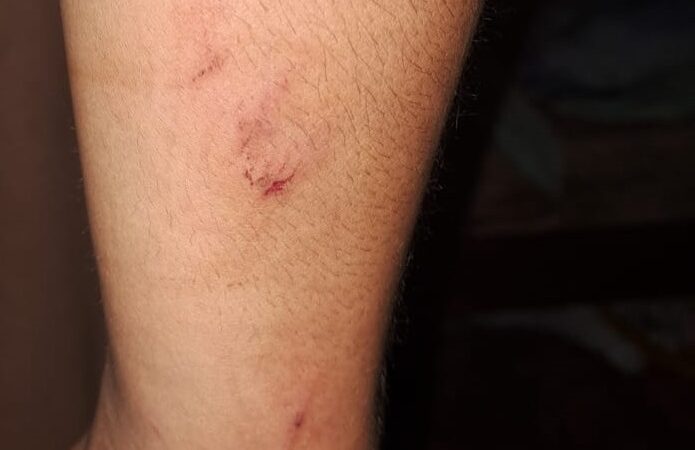 “En Caballeriza hay demasiada droga, muchos jóvenes que no estudian ni trabajan”