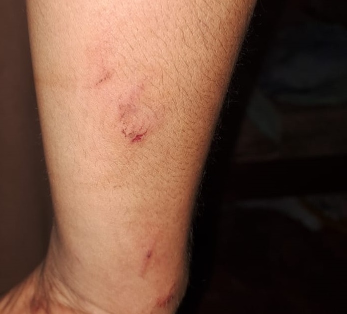 “En Caballeriza hay demasiada droga, muchos jóvenes que no estudian ni trabajan”