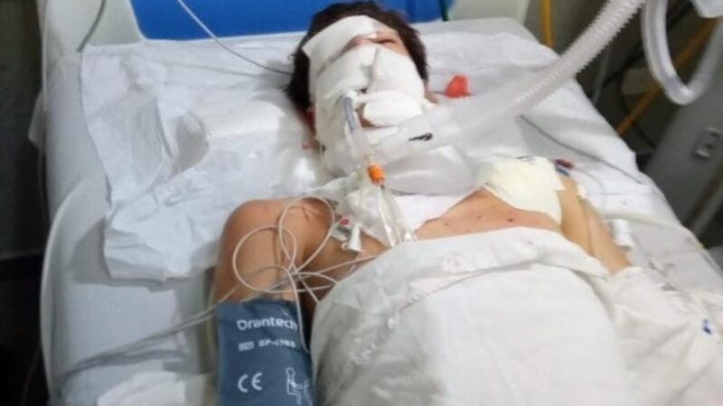 “Depende de un milagro”: es crítico el estado del menor accidentado con la moto en Mártires