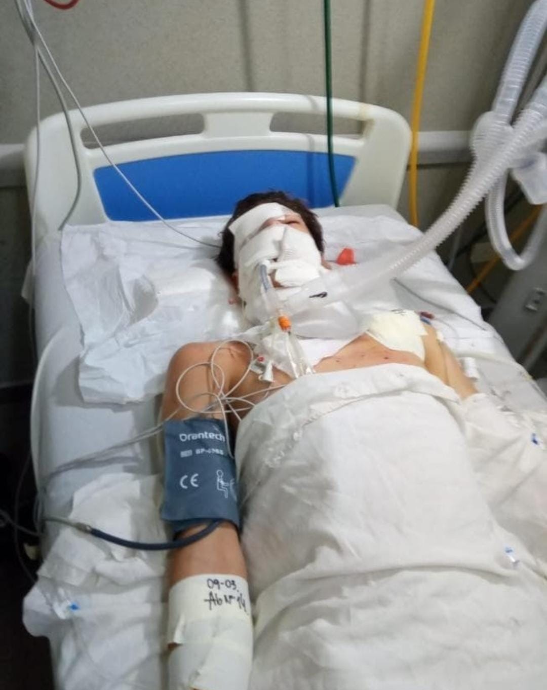 “Depende de un milagro”: es crítico el estado del menor accidentado con la moto en Mártires