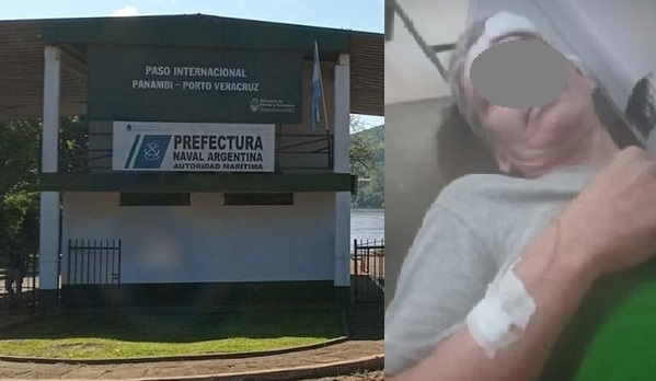 Comerciante fue baleado en la cabeza en un procedimiento de Prefectura en Panambí  