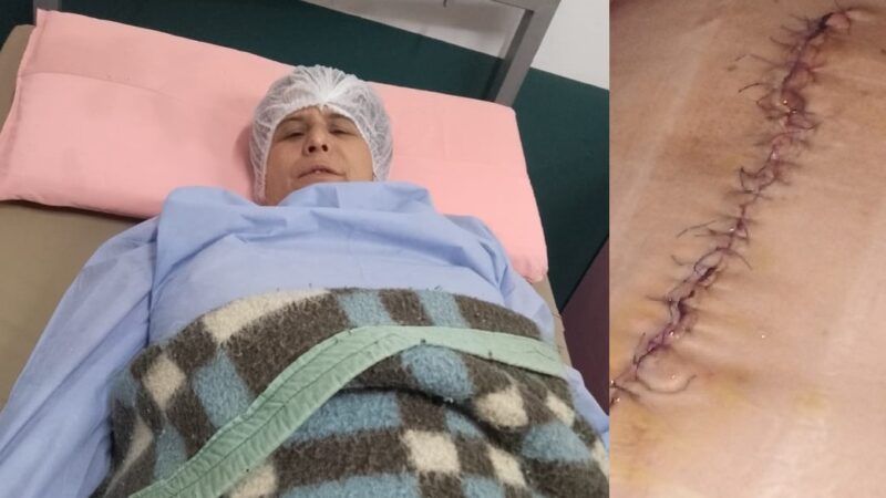 Una puñalada, 37 puntos en el abdomen y graves secuelas para toda la vida