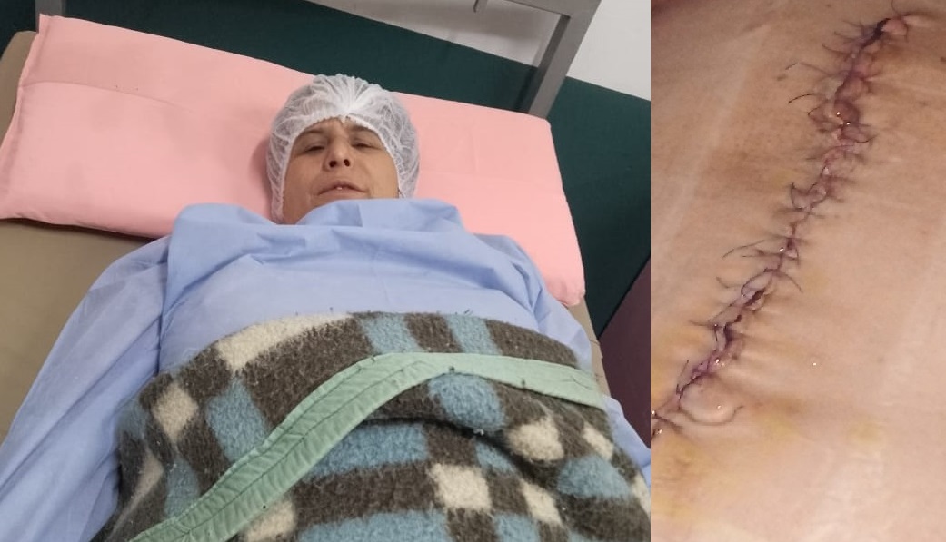 Una puñalada, 37 puntos en el abdomen y graves secuelas para toda la vida