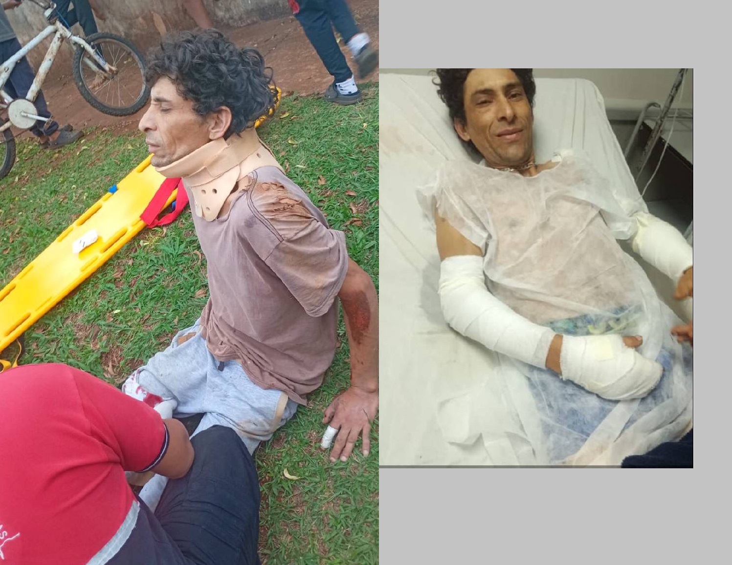 Se accidentó con la moto, no podrá trabajar por varios meses y necesita un medicamento costoso