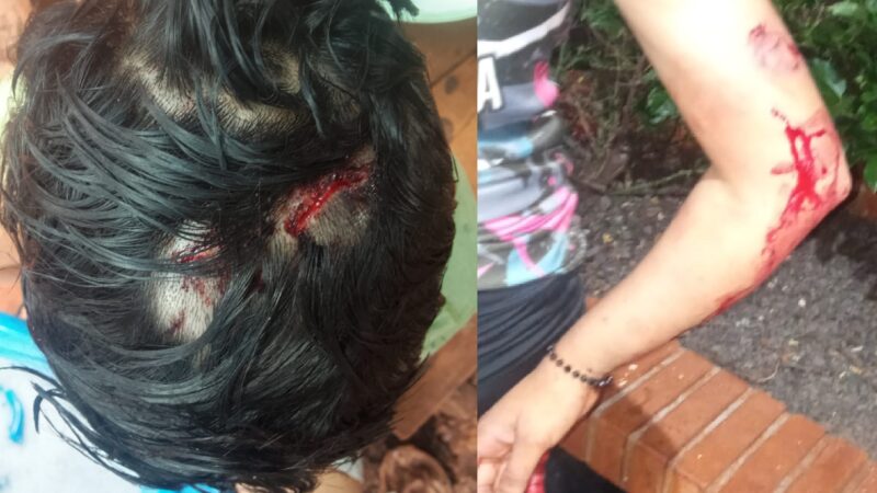 “Están esperando que maten a alguien”: denunciaron brutal agresión a dos hermanas en el barrio San José
