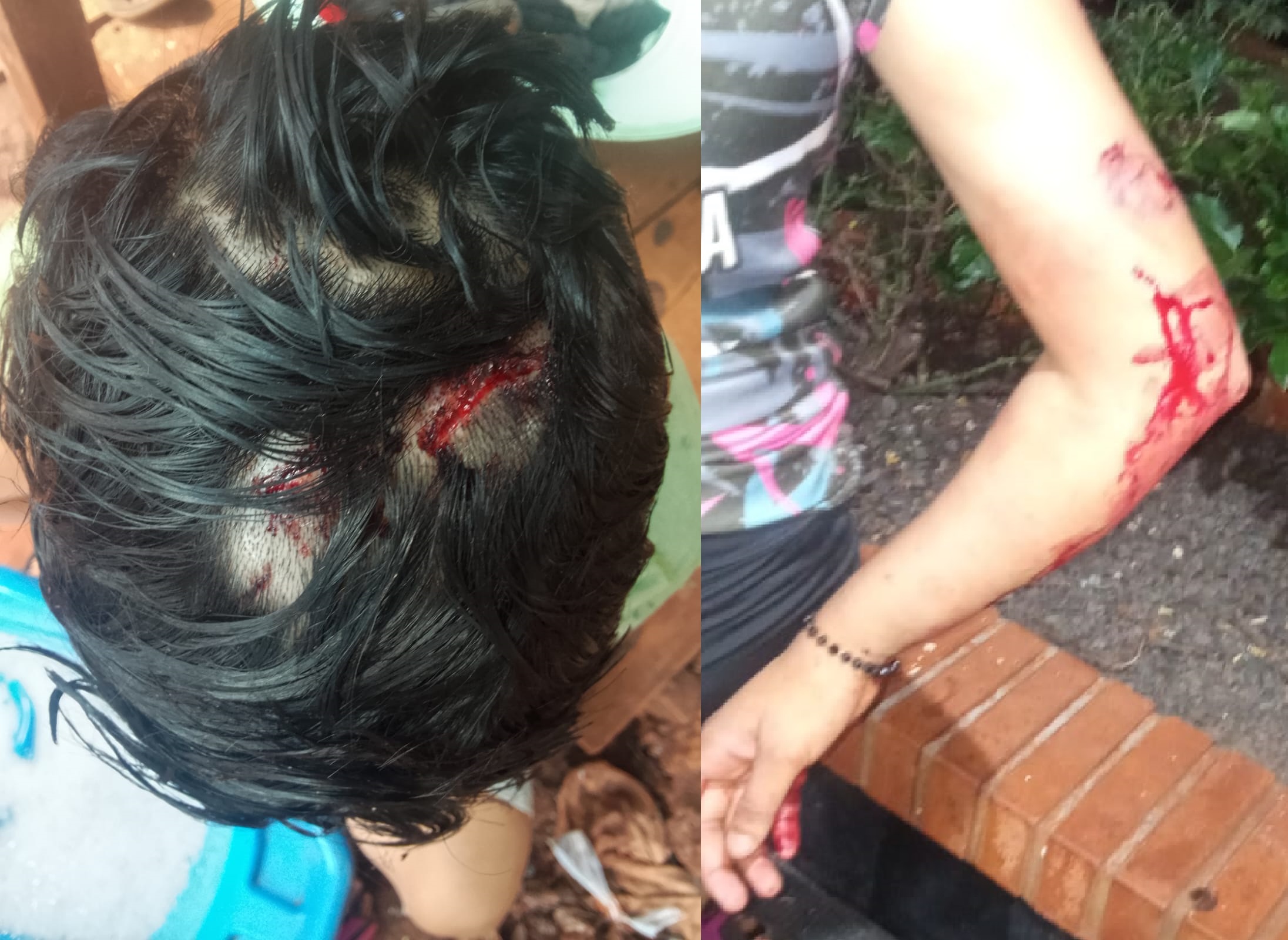 “Están esperando que maten a alguien”: denunciaron brutal agresión a dos hermanas en el barrio San José