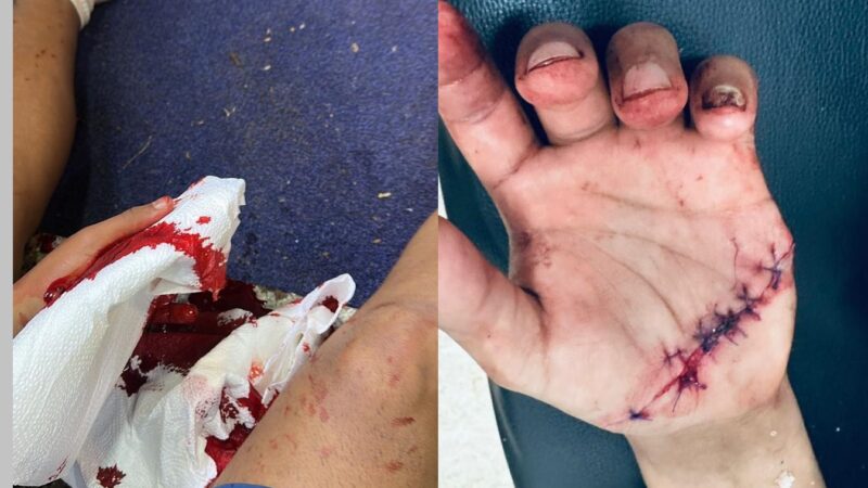 “Eran todos gurisitos, nos tiraban machetazos al cuello”: estudiantes de Educación Física atacados por una patota en el centro de Oberá