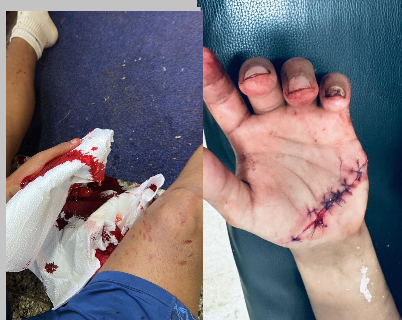 “Eran todos gurisitos, nos tiraban machetazos al cuello”: estudiantes de Educación Física atacados por una patota en el centro de Oberá