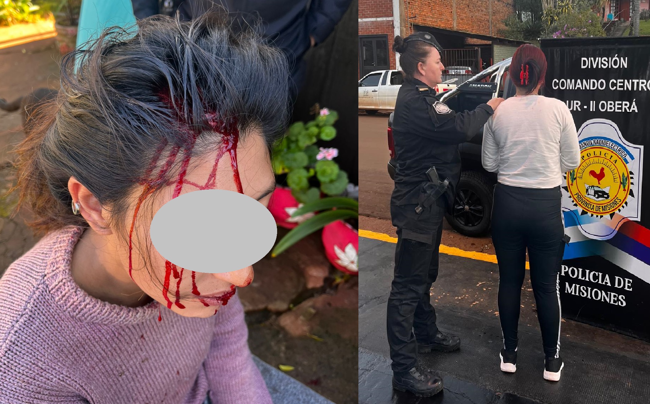 Una joven fue brutalmente atacada con un hierro por otra chica que irrumpió en su casa